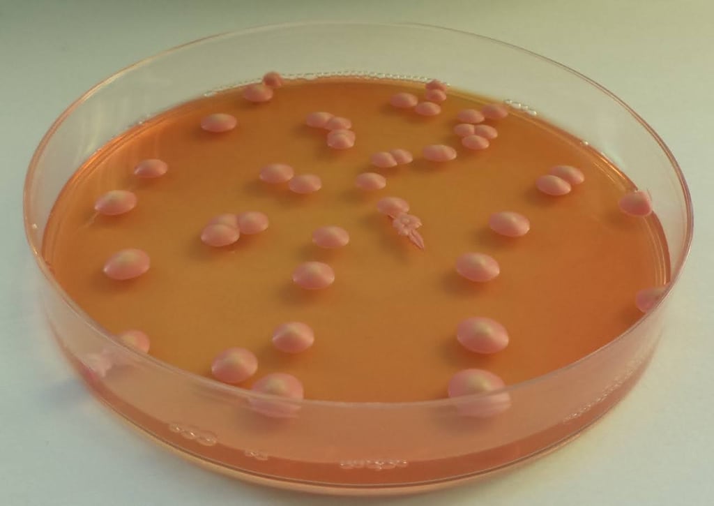 Brettanomyces bruxellensis colonies