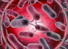 Filing an E Coli Claim? A Look At The Factors Affecting Your Case