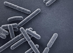 Proving Negligence in an E. Coli Lawsuit