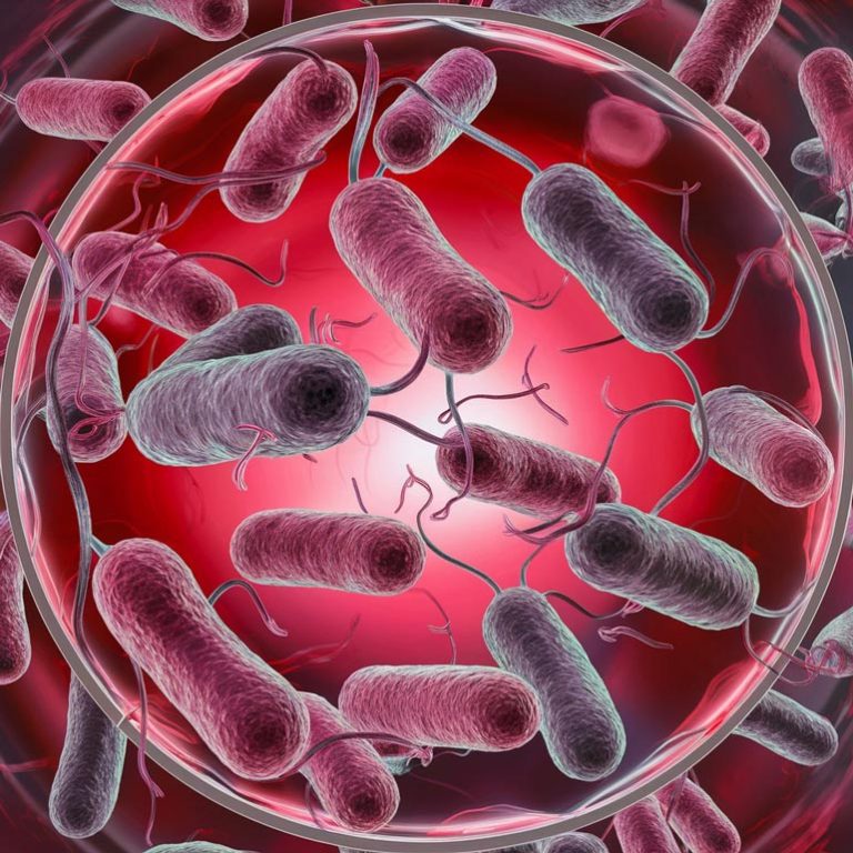 Filing an E Coli Claim? A Look At The Factors Affecting Your Case